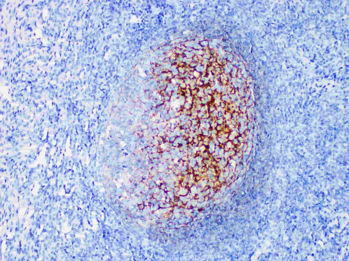 CD35 Monoclonal Antibody Synonyms CD35