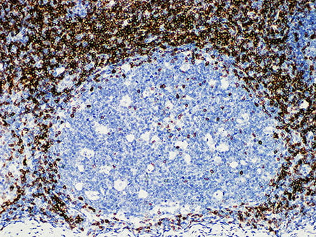 CD5 Monoclonal Antibody Synonyms CD5