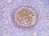 CD74 Monoclonal Antibody Synonyms CD74