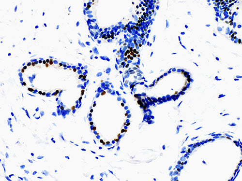ER Monoclonal Antibody stored at 2~8°C
