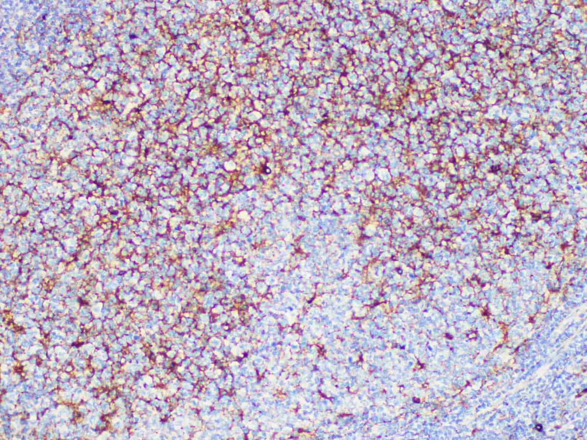 CD63 Monoclonal Antibody Synonyms CD63