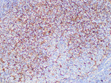 CD63 Monoclonal Antibody Synonyms CD63