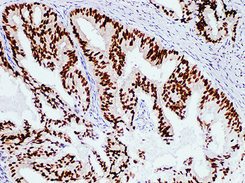AR Monoclonal Antibody Synonyms AR