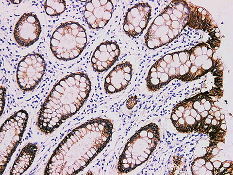 Claudin 4 Monoclonal Antibody Synonyms Claudin 4