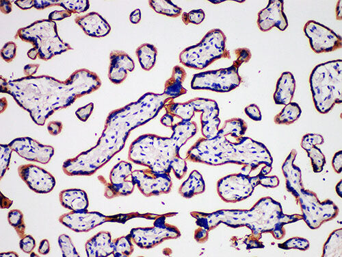 CD105 Monoclonal Antibody Synonyms CD105