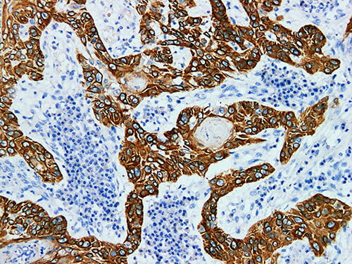 CK5 Monoclonal Antibody Synonyms CK5