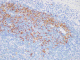 Fascin Monoclonal Antibody stored at 2~8°C
