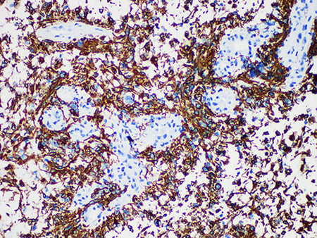 GFAP Monoclonal Antibody stored at 2~8°C