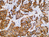 Her-2 Monoclonal Antibody stored at 2~8°C