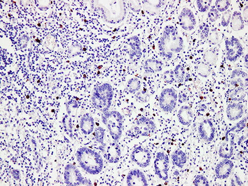 MCT Monoclonal Antibody Stored at 2~8°C