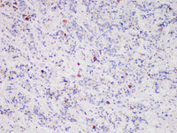 FSH Monoclonal Antibody stored at 2~8°C