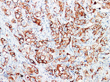 GCDFP-15 Monoclonal Antibody stored at 2~8°C