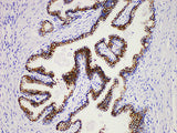 PSAP Monoclonal Antibody Stored at 2~8°C
