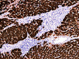 Arginase-1 Monoclonal Antibody Synonyms Arginase-1