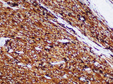 Melan A Monoclonal Antibody