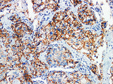 p120 Monoclonal Antibody Stored at 2~8°C
