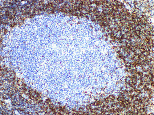 bcl-2 Monoclonal Antibody