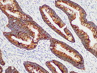 CK-LMW Monoclonal Antibody Synonyms CK-LMW
