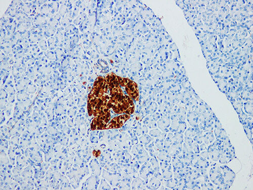 NSE Monoclonal Antibody Stored at 2~8°C