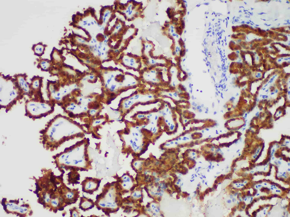 Galectin-3 Monoclonal Antibody stored at 2~8°C