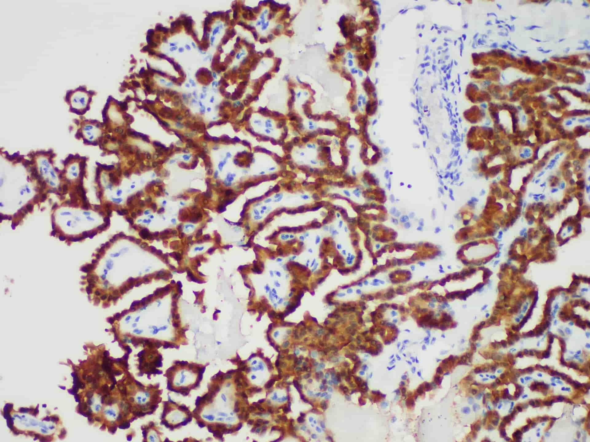 Galectin-3 Monoclonal Antibody stored at 2~8°C