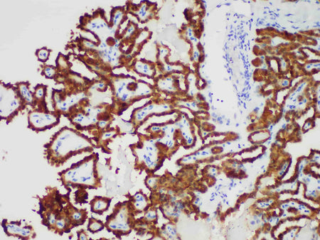 Galectin-3 Monoclonal Antibody stored at 2~8°C