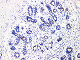 GATA3 Monoclonal Antibody stored at 2~8°C