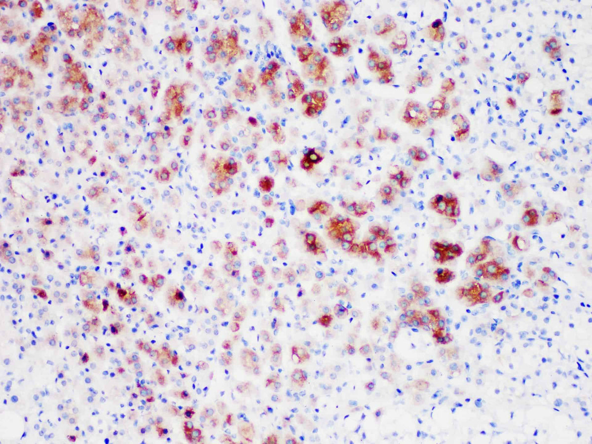 Inhibin, alpha Monoclonal Antibody