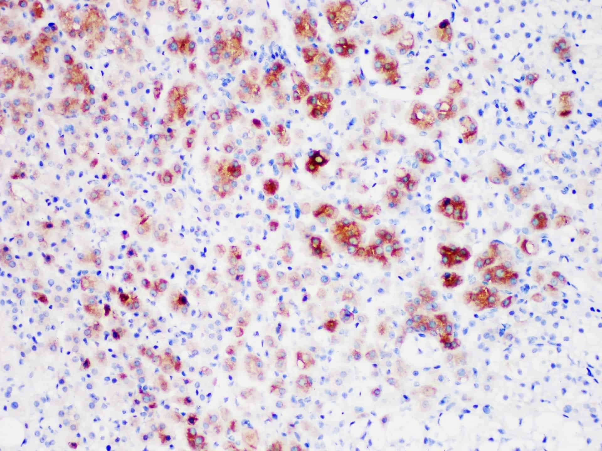 Inhibin, alpha Monoclonal Antibody