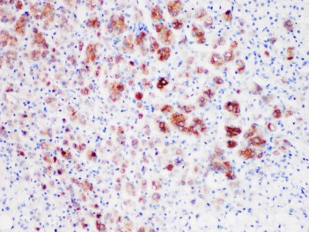 Inhibin, alpha Monoclonal Antibody