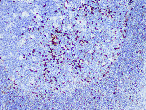 MUM1 Monoclonal Antibody Stored at 2~8°C