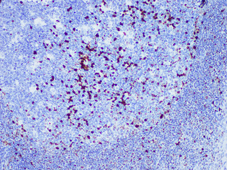 MUM1 Monoclonal Antibody Stored at 2~8°C