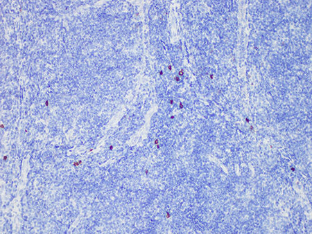 CD117 Monoclonal Antibody