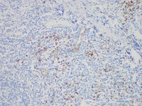 CD123 Monoclonal Antibody Synonyms CD123