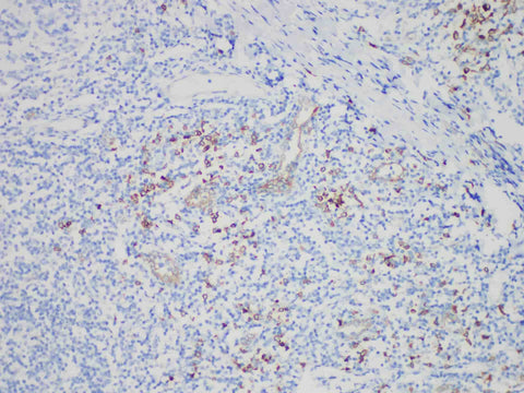 CD123 Monoclonal Antibody Synonyms CD123