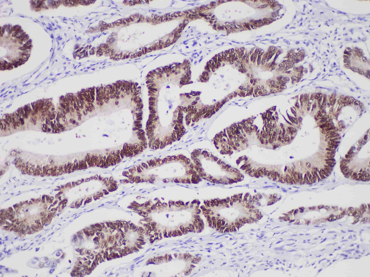 CDX-2 Monoclonal Antibody Synonyms CDX-2