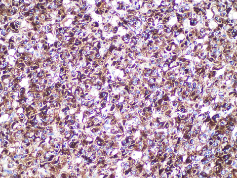 CgA Monoclonal Antibody Synonyms CgA