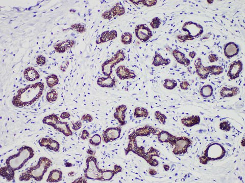 E-Cadherin Monoclonal Antibody stored at 2~8°C
