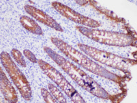 Ep-CAM Monoclonal Antibody
