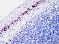 Ki-67 Monoclonal Antibody stored at 2~8°C Host Rabbit