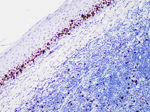 Ki-67 Monoclonal Antibody stored at 2~8°C Host Rabbit