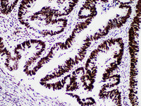 MSH6 Monoclonal Antibody Stored at 2~8°C Host Rabbit