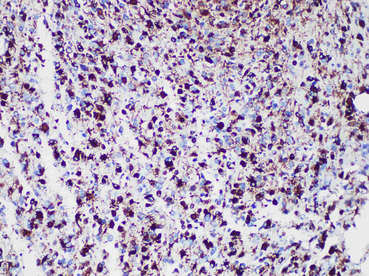 GFAP Monoclonal Antibody stored at 2~8°C