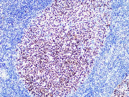 bcl-6 Monoclonal Antibody