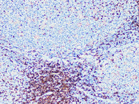 CD4 Monoclonal Antibody Synonyms CD4