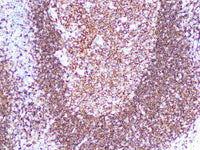 CD19 Monoclonal Antibody Synonyms CD19
