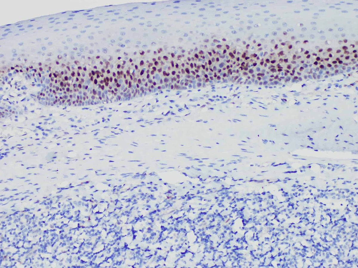 Cyclin D1 Monoclonal Antibody Synonyms Cyclin D1
