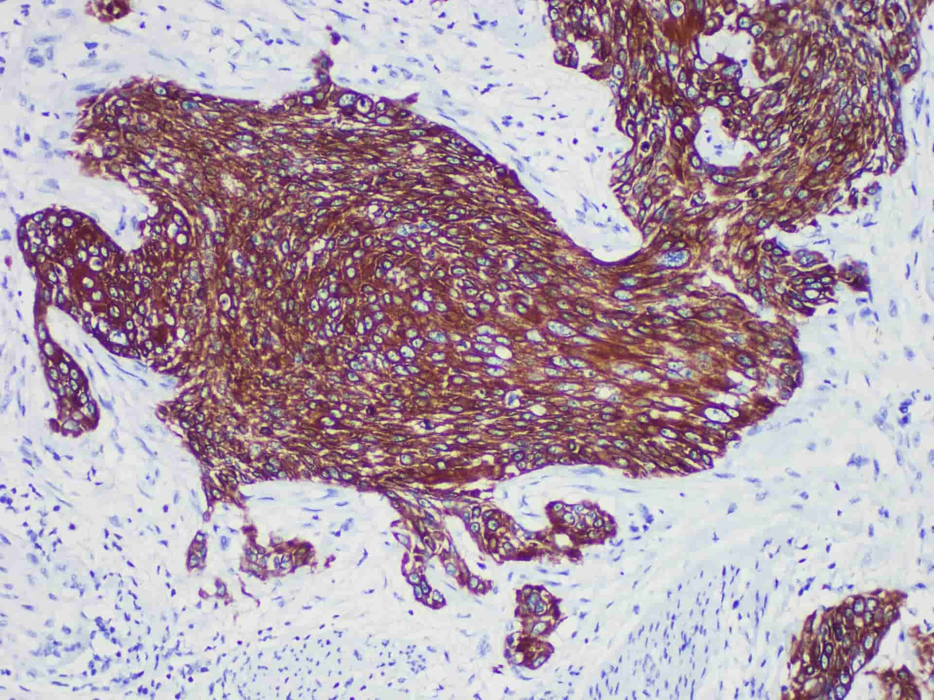CK-HMW Monoclonal Antibody