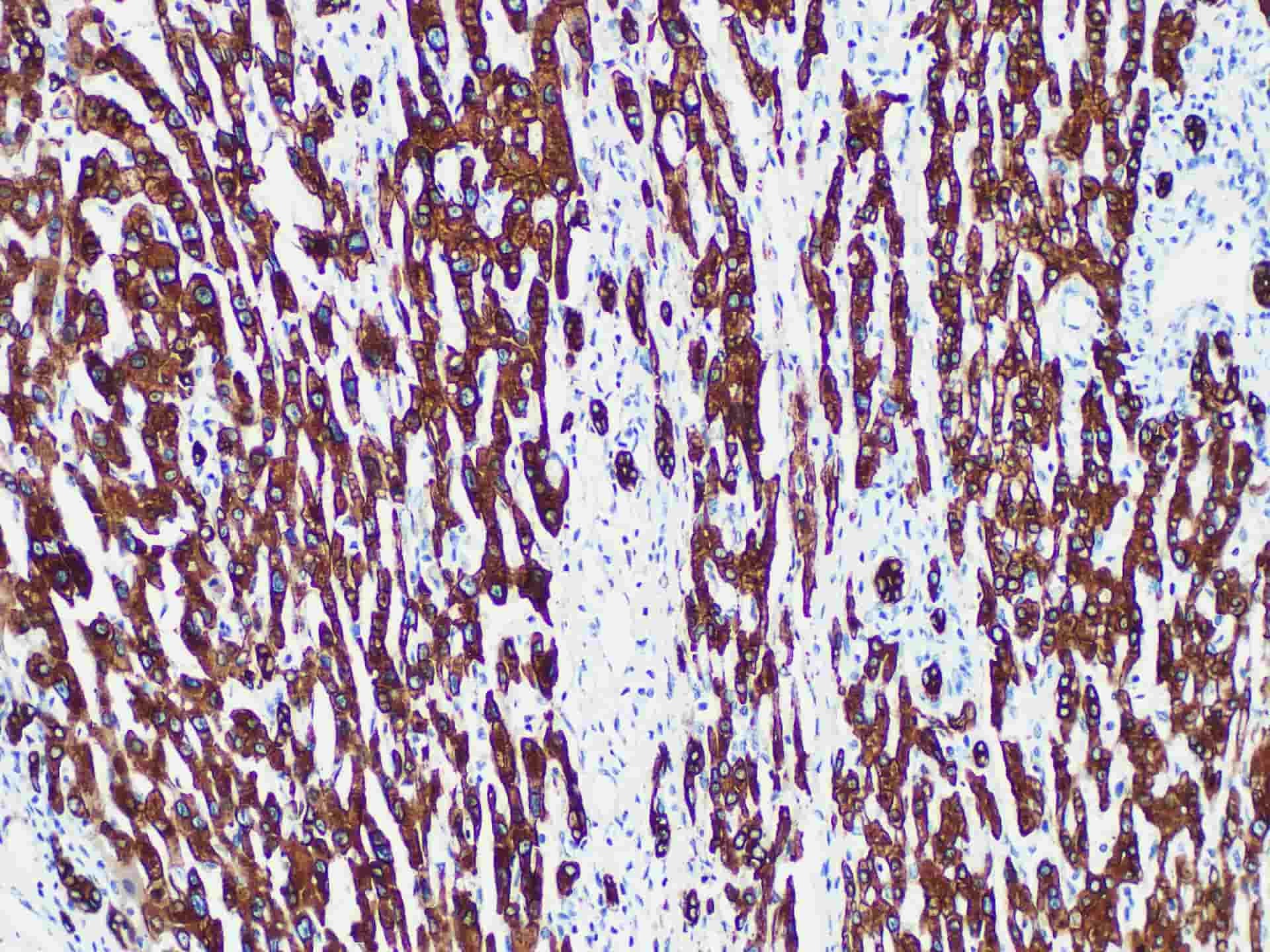 CK8/18 Monoclonal Antibody Synonyms CK8/18