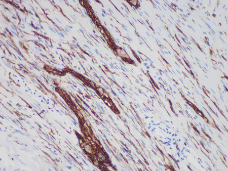 CD56 Monoclonal Antibody Synonyms CD56